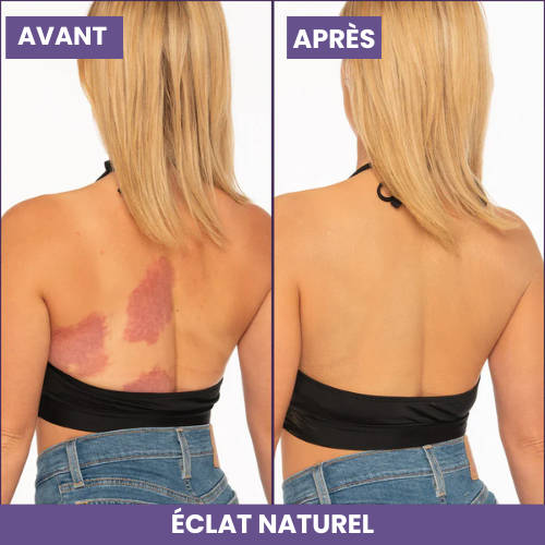 BLUNIE | Kit Perfecteur Éclat Corps