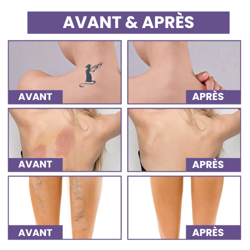 BLUNIE | Kit Perfecteur Éclat Corps